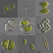 A variety of microscopic unicellular and colonial freshwater algae