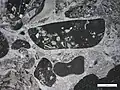 Photomicrograph (PPL) of lithoclasts and skeletal material in an intrasparite.