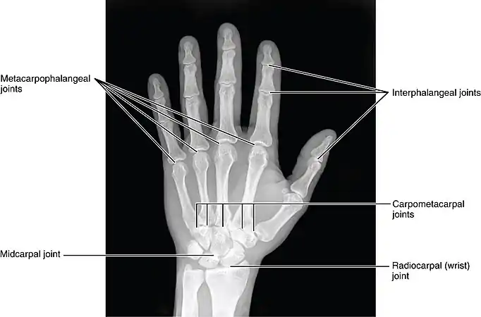 X-ray showing joints