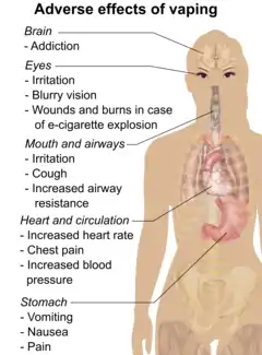 Serious adverse effects of vaping include corneoscleral lacerations or ocular burns or death after e-cigarette explosion. Less serious adverse effects of vaping include eye irritation, blurry vision, dizziness, headache, throat irritation, coughing, increased airway resistance, chest pain, increased blood pressure, increased heart rate, nausea, vomiting, and abdominal pain.