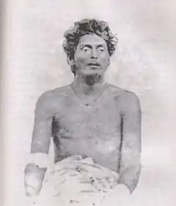 Bagha Jatin after the final battle. Balasore, 1915