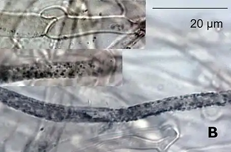 Hyphae with clamp connections