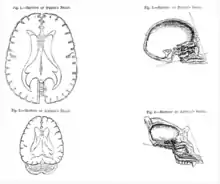 Horizonal sections through "Negro's brain" and "Animal's brain", and cross sections seen from the side of "Negro's skull" and "Animal's skull".