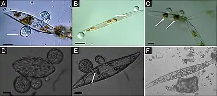 Image 96Chytrid parasites of marine diatoms. (A) Chytrid sporangia on Pleurosigma sp. The white arrow indicates the operculate discharge pore. (B) Rhizoids (white arrow) extending into diatom host. (C) Chlorophyll aggregates localized to infection sites (white arrows). (D and E) Single hosts bearing multiple zoosporangia at different stages of development. The white arrow in panel E highlights branching rhizoids. (F) Endobiotic chytrid-like sporangia within diatom frustule. Bars = 10 μm. (from Marine fungi)