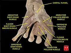 Adductor pollicis muscle