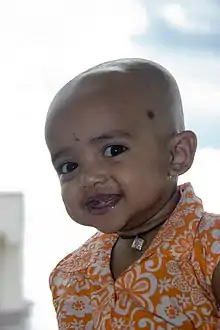 Image 18A Hindu girl after her Karnavedha rite of passage (ear piercing) (from Samskara (rite of passage))