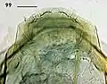 Female terminal abdominal segment