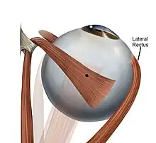 Text indicates Lateral Rectus