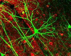 Pyramidal neuron visualized by green fluorescent protein (GFP)