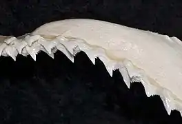 Upper teeth