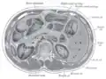 Transverse section through the middle of the first lumbar vertebra, showing the relations of the pancreas.