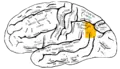 Lateral surface of left cerebral hemisphere, viewed from the side. Angular gyrus is shown in orange.