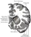 Coronal section through anterior cornua of lateral ventricles