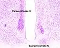 Cross-section of the monkey hypothalamus displays two of the major hypothalamic nuclei on either side of the fluid-filled third ventricle.