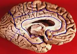 Human brain inferior-medial view. Parahippocampal gyrus labelled as #5