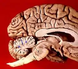 Human brain midsagittal view description