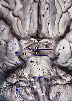 Human brainstem anterior view