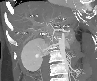 CT scan showing the liver and a kidney