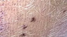 Magnified reddish leech bites on a cow's udder