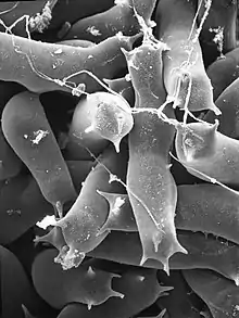 electromicrograph of Lobosporangium transversalis