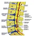 Lumbar disc lesions, classification