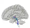 Tractography showing medial lemniscus