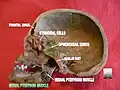 Medial pterygoid muscle