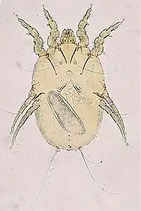 Megninia feather mite of birds (the oval object is an egg)