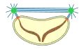 closed  extranuclear  pleuromitosis