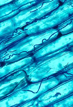 A microscopic view of blue-stained cells, some with dark wavy lines in them