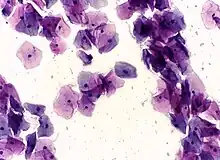 Micrograph of a normal pap smear