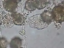 A hypha of Zoophagus insidians runs from the top of the image to the bottom of the image slightly left of center. A rotifer is trapped on the right side of the hypha.