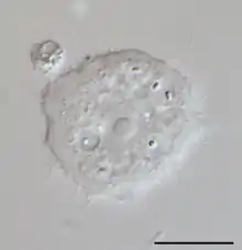 Acanthamoeba sp. (Lobosa: Discosea)