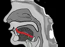 The shape of tongue when pronouncing ㄴ