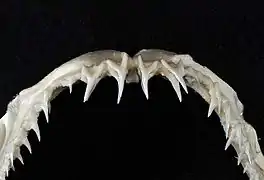 Upper teeth