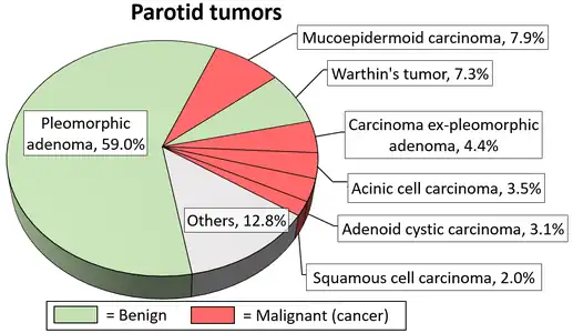 Relative incidence of parotid tumors.