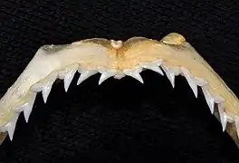 Upper teeth