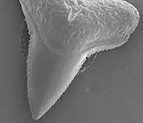 Electron micrograph of an upper tooth