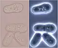 Division stages of Schizosaccharomyces in bright and dark field light microscopy