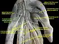 Flexor digiti minimi brevis muscle