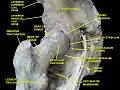 Hip joint. Lateral view. Transverse acetabular ligament