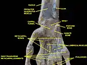 Wrist joint, deep dissection. Anterior palmar view.