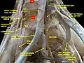 Lumbar and sacral plexus. Deep dissection. Anterior view.