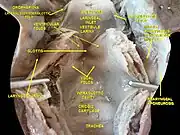 Larynx, pharynx and tongue.Deep dissection, Posterior view.