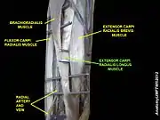 Extensor carpi radialis longus muscle