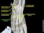 Extensor indicis muscle