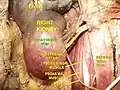 Inferior mesenteric artery