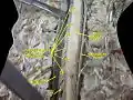 Spinal cord. Spinal membranes and nerve roots.Deep dissection. Posterior view.