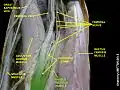 Vastus medialis muscle