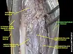 Extensor digitorum muscle